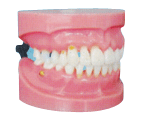 牙周病演示模型B10031 