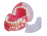 三岁乳恒牙交替解剖模型B10030 