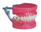 牙周病演示模型B10032 
