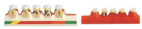 牙周病分类模型B10014